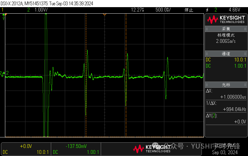 Ultrasonic Transducer Detection System